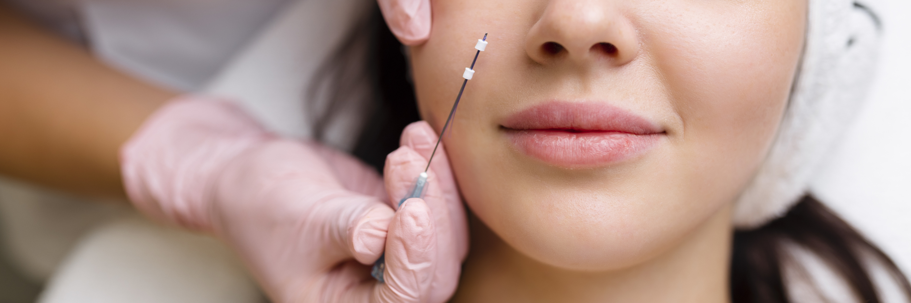 PDO thread lift non-surgical facelift