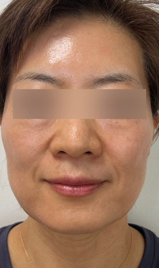 After
