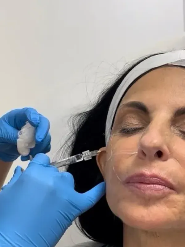 Dermal Fillers - inline